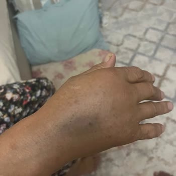 İzmir Tınaztepe Galen Bayraklı Hastanesi Beyin MR Çekimi