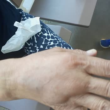 İzmir Tınaztepe Galen Bayraklı Hastanesi Beyin MR Çekimi