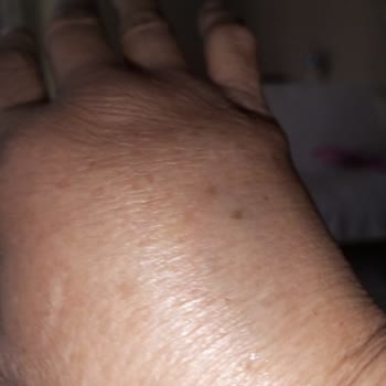 İzmir Tınaztepe Galen Bayraklı Hastanesi Beyin MR Çekimi