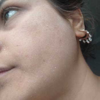 Dr. Öz Klinik Blemish Leke Karşıtı Beyazlatıcı Krem Pütür Pütür Yaptı