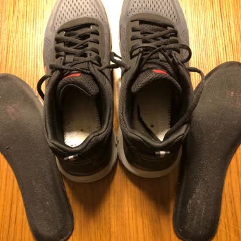 Skechers Ayakkabısındaki Problem Ve SuperStep'in İlgisizliği