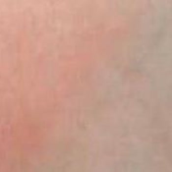 Zehra Hotels & Villas Klima ve Sivrisinek