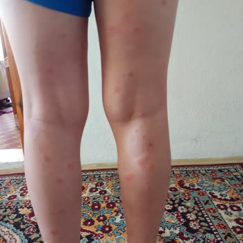 Afyonkarahisar Belediyesi Sultandağı Belediyesi Çalışmıyor