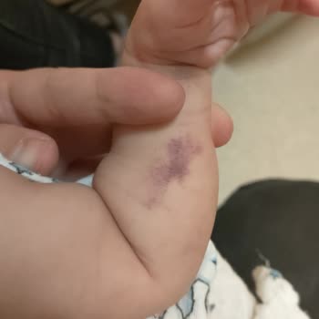 Yaşam Hastanesi (Düztepe) Hastanemizde Kötü Muamele