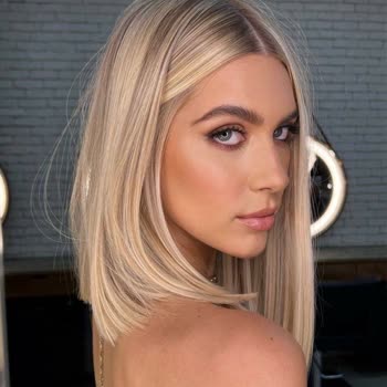 Emre Ayaksız Hair Palace Saçım Geri Dönüşü Olmaz Bir Şekilde Mahvoldu