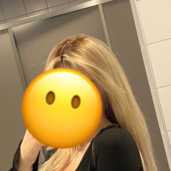 Emre Ayaksız Hair Palace Saçım Geri Dönüşü Olmaz Bir Şekilde Mahvoldu