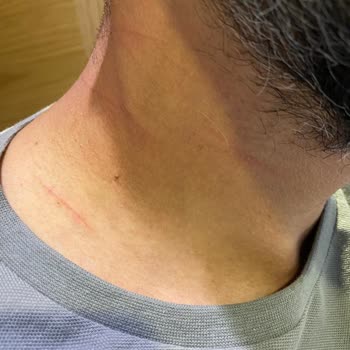 The Green Park Hotels And Resorts Gaziantep, Duş Sorunu!