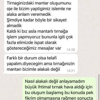 Eylül Öztürk Nail Spa Protez Tırnaklarımın Hava Alması Ve Mantar Oluşumu