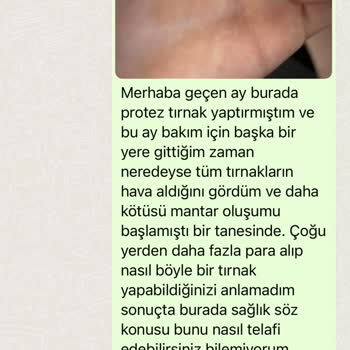 Eylül Öztürk Nail Spa Protez Tırnaklarımın Hava Alması Ve Mantar Oluşumu