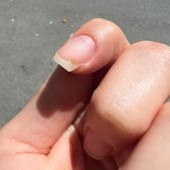 Eylül Öztürk Nail Spa Protez Tırnaklarımın Hava Alması Ve Mantar Oluşumu