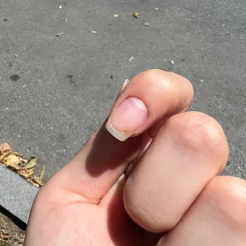 Eylül Öztürk Nail Spa Protez Tırnaklarımın Hava Alması Ve Mantar Oluşumu