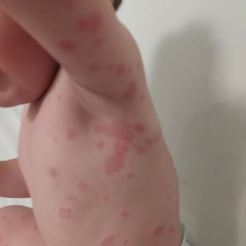 Erdem Hastanesi Çocuk Doktoru Yüzünden Çocuğum Canından Oluyordu