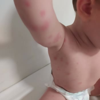 Erdem Hastanesi Çocuk Doktoru Yüzünden Çocuğum Canından Oluyordu