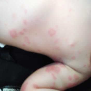 Erdem Hastanesi Çocuk Doktoru Yüzünden Çocuğum Canından Oluyordu