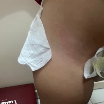 Prima Premium Care Bant Kopuyor