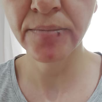 Lirlips.shop Ürün İadesi Talebi