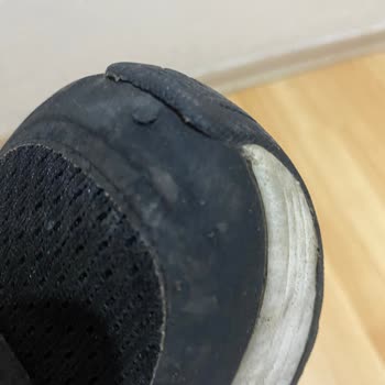 Skechers Spor Ayakkabının Sağ Ve Sol Ön Kısımları Yırtık Ve Rengi Soldu.