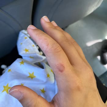 Erzurum Şehir Hastanesi Doktor Tavrı!