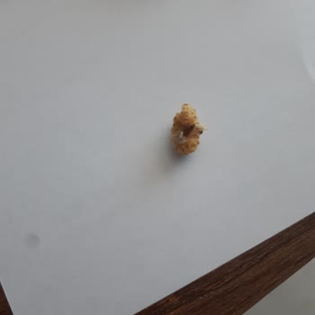 Harras Marka Kuruyemiş Ve Meyve Kurusu Küflü Kurtlu Ürün