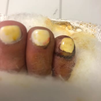 Serenis Hotel Serenis Otel - Side De ''Yangın Tüpü Faciası''