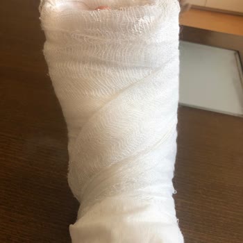 Serenis Hotel Serenis Otel - Side De ''Yangın Tüpü Faciası''