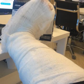 Serenis Hotel Serenis Otel - Side De ''Yangın Tüpü Faciası''