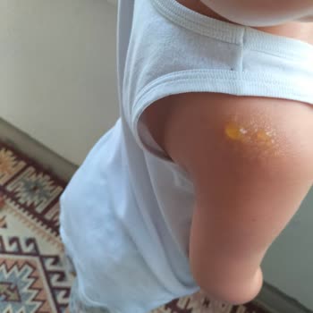 Cire Aseptine Markanın Kremi Suyla Akıyor!