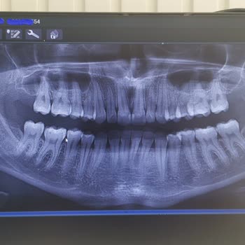 İstanbul Diş Akademisi Doktoru Yanıltıyor