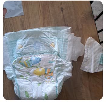 Prima Bebek Bezi Yan Bandi Kopması
