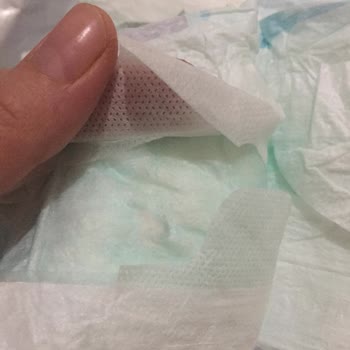 Molfix 4 Numara Bez Yırtık Çıktı