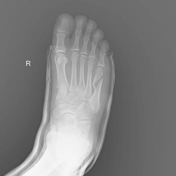 Allianz Sigorta&nbsp; Yarı Yolda Bıraktı