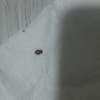 Bambi Yatak Sattığı Sorunlu Ürünü Sahiplenmiyor