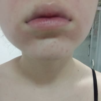 Nivea Canlandırıcı Yüz Köpüğü Normal Ciltler Yüzümü Yaktı