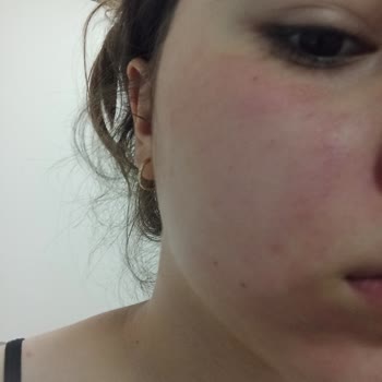 Nivea Canlandırıcı Yüz Köpüğü Normal Ciltler Yüzümü Yaktı