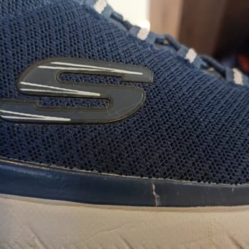 A101 - Skechers Ayakkabı Sorunu