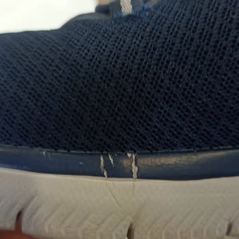 A101 - Skechers Ayakkabı Sorunu