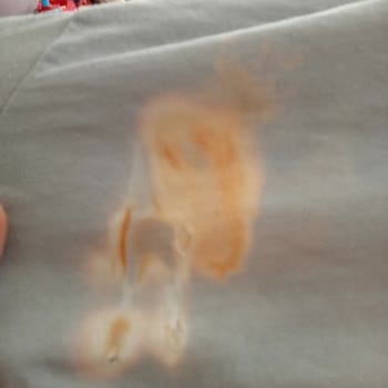 Vanish Kosla Çamaşır Suyu Mu Yoksa Leke Çıkarıcı Mı?