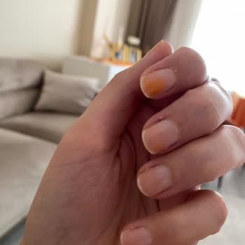 Pastel Kozmetik Pastel Ojede Tırnakta Turuncu Leke Oluşması