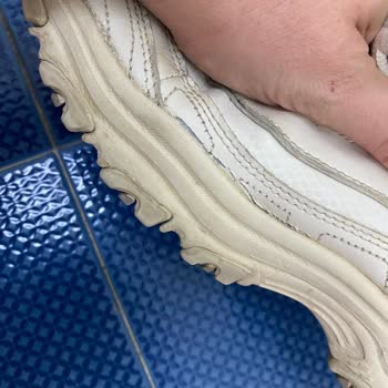 Skechers Ayakkabımın Kenarları Açıldı