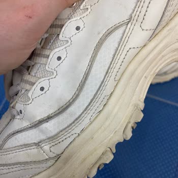 Skechers Ayakkabımın Kenarları Açıldı