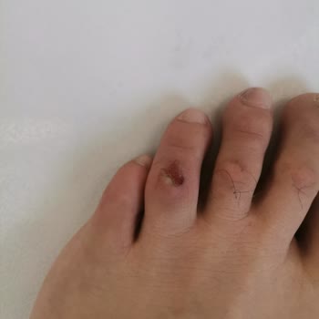 Dexter Türkiye Ayakkabının Parmağımı Yaralaması!