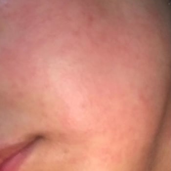 Eskişehir Büyükşehir Belediyesi Eskişehir Kireçli Su