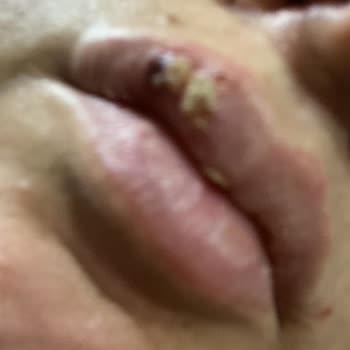 Kübra Tel Kt Güzellik Merkezi (Şanlıurfa) Zarar Verdi