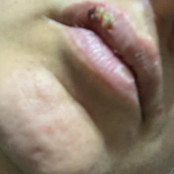 Kübra Tel Kt Güzellik Merkezi (Şanlıurfa) Zarar Verdi