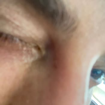 Kübra Tel Kt Güzellik Merkezi (Şanlıurfa) Zarar Verdi