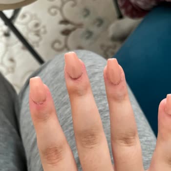 Aymira Koçaklı Yaşam Merkezi Kötü Hizmette