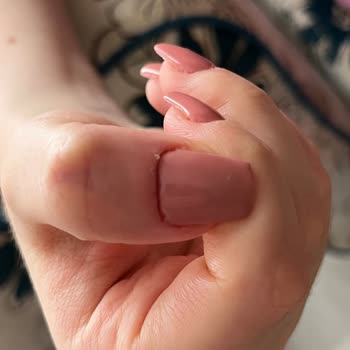 Aymira Koçaklı Yaşam Merkezi Kötü Hizmette