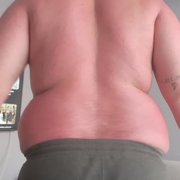 Benri Gratis Ten Aldığım Güneş Kremi Çok Kötü Çıktı