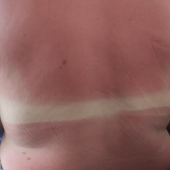 Sebamed Orijinal Olup Olmadığını Nasıl Anlarız