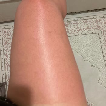 Nivea Güneş Kreminin Hiçbir İşe Yaramaması